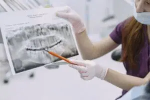 https://www.pexels.com/photo/dentist-explaining-the-x-ray-result-5622267/ Periodontist explaining the cost of all-on-4 dental implants to a patient