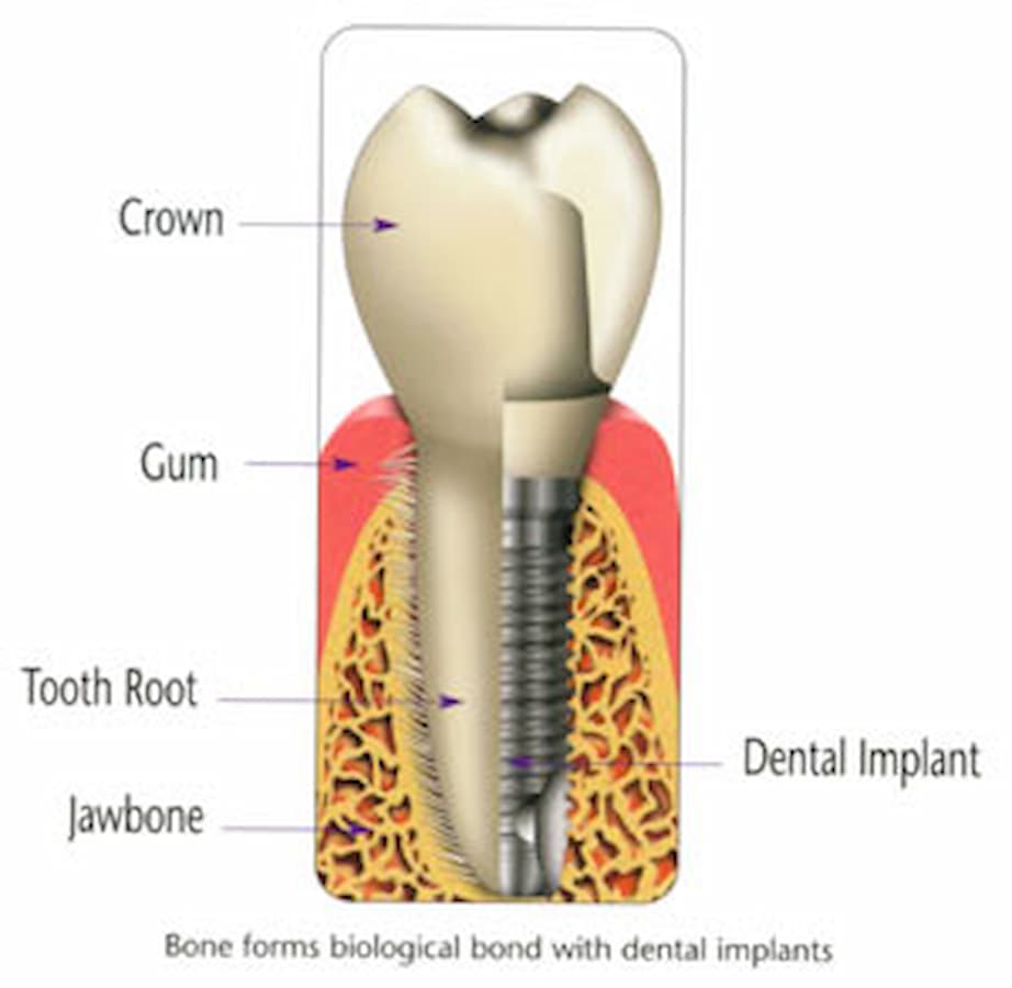 tooth graphic