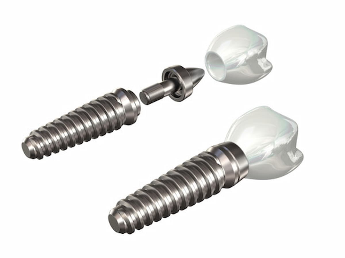 dental implants