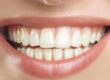 https://www.pexels.com/photo/beautiful-gummy-smile-with-white-teeth-16212691/ Close-up of a white smile